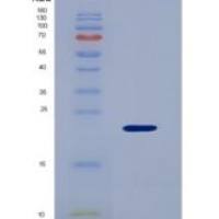 人胰岛素样生长因子结合蛋白3(IGFBP3)重组蛋白