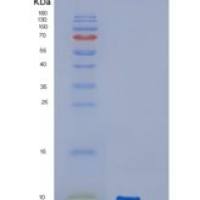 人胰岛素样生长因子2(IGF2)重组蛋白