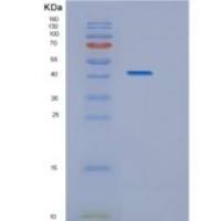 人组蛋白脱乙酰基酶8(HDAC8)重组蛋白