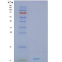 人肝癌源性生长因子(HDGF)重组蛋白
