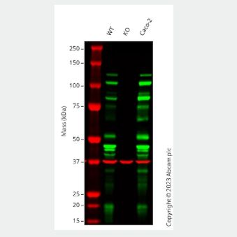 Anti-E Cadherin antibody [EP700Y] - IntercellμLar Junction Marker