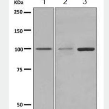 Anti-TRPM5 antibody [EPR7504]