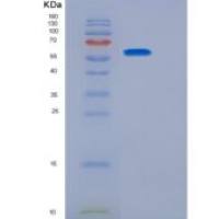 人白介素23受体(IL23R)重组蛋白