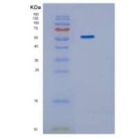 人IMPDH1重组蛋白