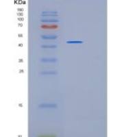 人KRT19重组蛋白