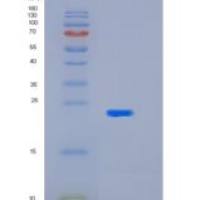 人杀伤细胞免疫球蛋白样受体2DL1(KIR2DL1)p58重组蛋白