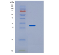 人白介素2受体γ(IL2Rg)多克隆抗体