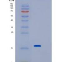 大肠杆菌IPP-POZ结构域(1-157氨基酸)重组蛋白