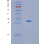 人白介素34(IL34)重组蛋白