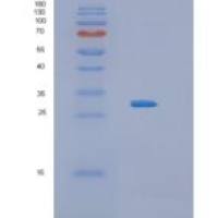 人白介素34(IL34)重组蛋白