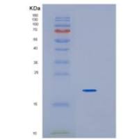 人生长激素(GH)重组蛋白