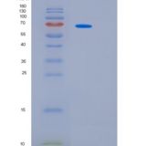 小鼠白细胞介素-6受体亚单位β重组蛋白