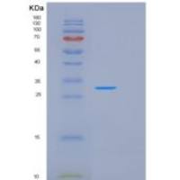 人激肽释放酶2(KLK2)重组蛋白
