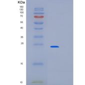 人V-Ki-Ras2 Kirsten大鼠肉瘤病毒癌基因同源物(KRAS)重组蛋白
