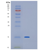人干扰素调节因子1(IRF1)重组蛋白