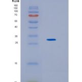 人KCTD5重组蛋白