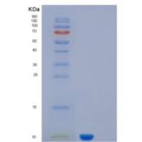 人KAAG1重组蛋白
