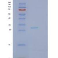 人JAZF1重组蛋白