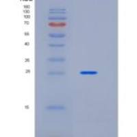 人白介素21受体(IL21R)重组蛋白