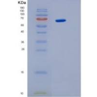 人白细胞介素6信号传感器重组蛋白
