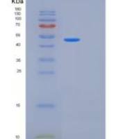人KRT20重组蛋白
