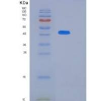 人Kruppel样因子12(KLF12)重组蛋白