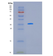 人白介素12(IL12)重组蛋白