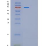 人整合素β1(ITGb1)重组蛋白