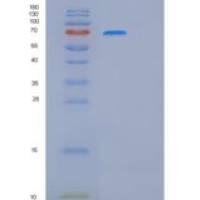 人整合素β1(ITGb1)重组蛋白