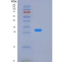人激肽释放酶15(KLK15)重组蛋白