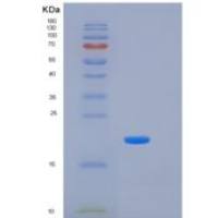 人激肽释放酶7(KLK7)重组蛋白