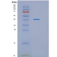 人Kruppel样因子3(KLF3)重组蛋白