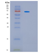 小鼠白细胞介素-6受体亚单位β重组蛋白