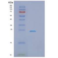 人肌苷三磷酸酶(ITPA)重组蛋白