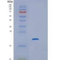 人Interleukin 6重组蛋白