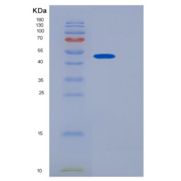 人JMJD6重组蛋白
