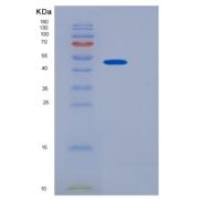 人JMJD6重组蛋白