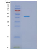 人异戊酰辅酶A脱氢酶(IVD)重组蛋白