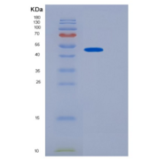 人JMJD6重组蛋白