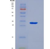 人激肽释放酶10(KLK10)重组蛋白