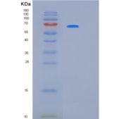 人KRT5重组蛋白