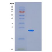 人杀伤细胞免疫球蛋白样受体2DS4(KIR2DS4)p50 KIR重组蛋白