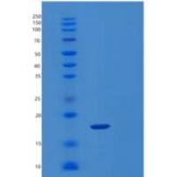 人杀伤细胞凝集素样受体亚家族C成员2(KLRC2)重组蛋白