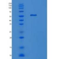 人KRT16重组蛋白