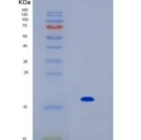 人白介素17F(IL17F)重组蛋白
