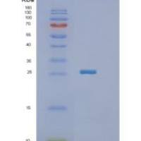 人连接附着分子2(JAM2)重组蛋白