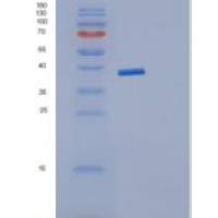 人JMJD7重组蛋白