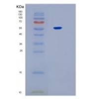 人白介素17受体B(IL17RB)多克隆抗体