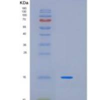 人杀伤细胞免疫球蛋白样受体3DL1(KIR3DL1)Cytoplasmic tail重组蛋白