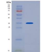 人Janus激酶2(JAK2)重组蛋白